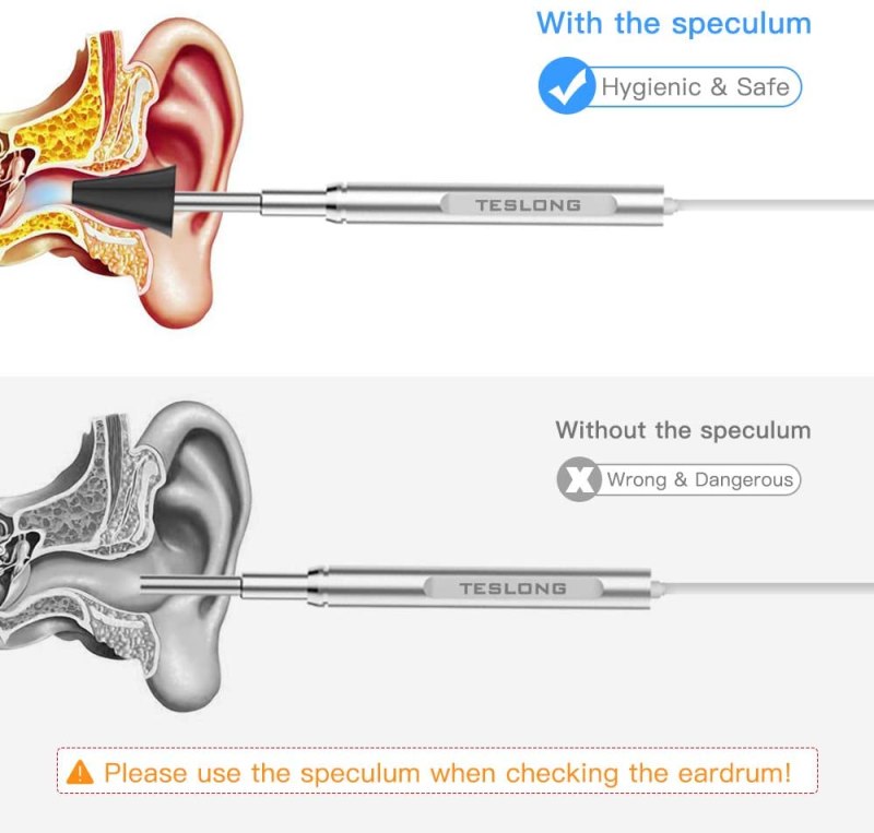 WiFi Otoscope for iPhone Android Ultra-Slim Wireless Ear Scope Camera with Replaceable Otoscope Specula Waterproof Washable 4